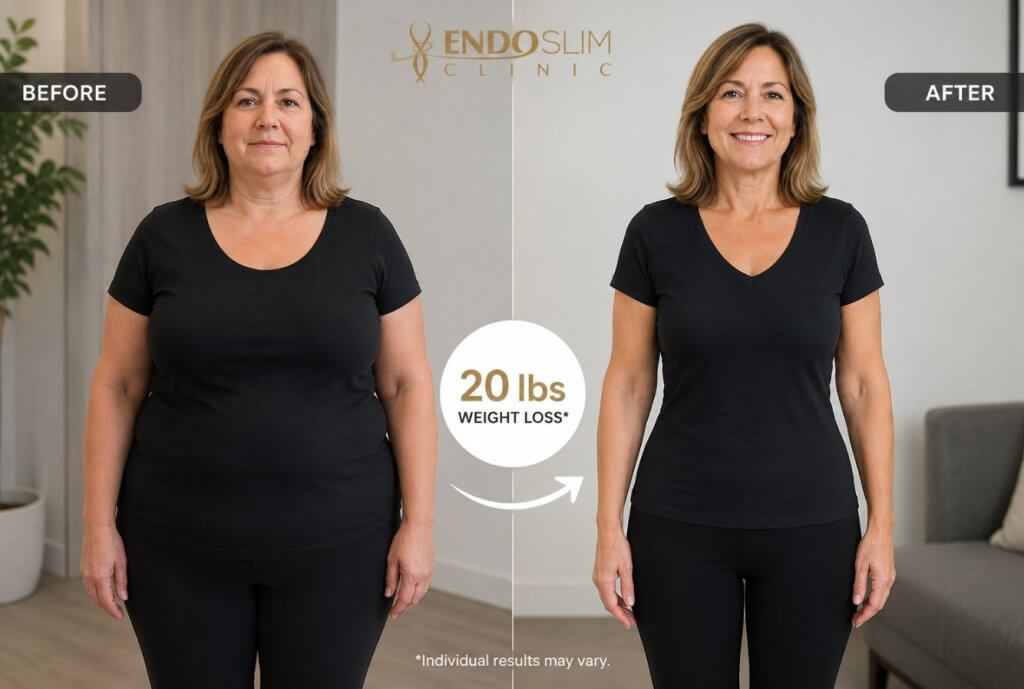 How to Lose Up to 20% of Your Body Weight Without Traditional Weight Loss Surgery