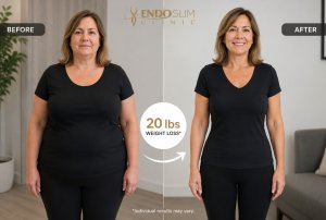 How to Lose Up to 20% of Your Body Weight Without Traditional Weight Loss Surgery