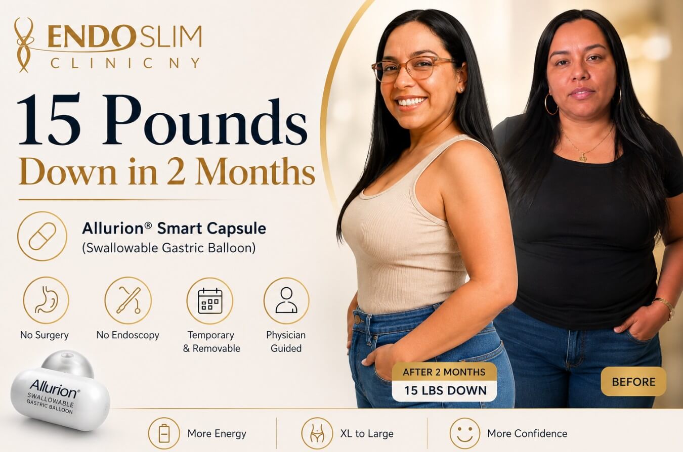 Allurion Smart Capsule before and after results showing 15 pounds lost in 2 months at EndoSlim Clinic NY