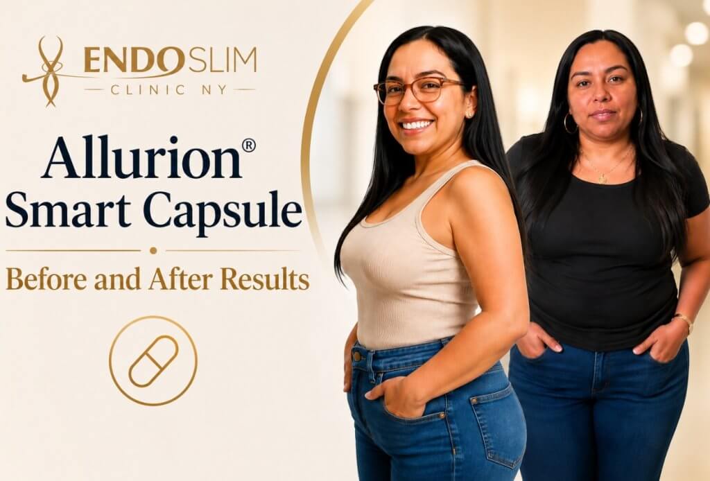 Allurion® Smart Capsule Results After 2 Months: 15 Pounds Down