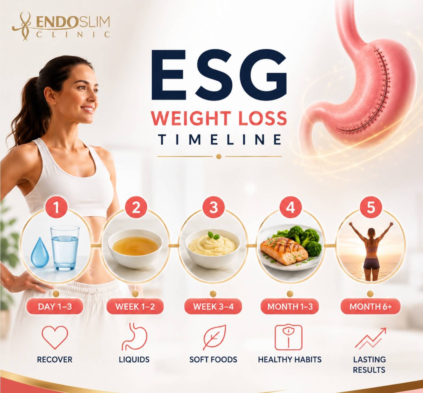 ESG weight loss timeline showing recovery, liquid diet, soft foods, healthy eating, and long-term results after Endoscopic Sleeve Gastroplasty